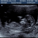 An ultrasound image