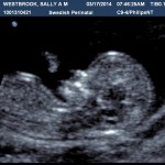 Ultrasound image